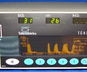 Datex Tonocap betegőrző monitor